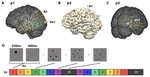 Intracranial recordings show evidence of numerosity tuning in human parietal cortex