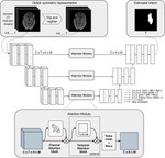 PerfU-Net: Baseline infarct estimation from CT perfusion source data for acute ischemic stroke